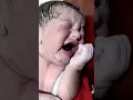Download Lagu A Miracle Begins ✨ | Newborn Just After Birth Moment