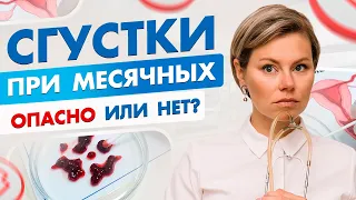 Сгустки во время месячных | Норма или патология? Гинеколог Екатерина Волкова