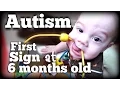 AUTISM First Sign at 6 months old