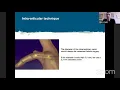 Intramedullary Compression Fixation of Metacarpal and Phalangeal Fractures