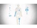 How much of the human body can be made bionic
