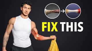 It's Weird, But It Re-Builds Your Tendons In 30 Days