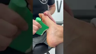 Foot Rehab For Runners 