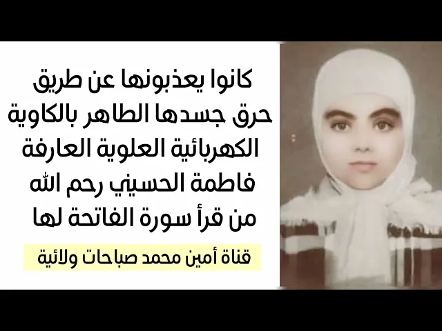 ⁣شهرين كاملين وهم يعذبونها بالكاوية الكهربائية والعصي حتى رحلت رحم الله من قرأ لها سورة الفاتحة