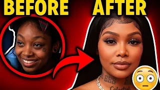 Summer Walker s Surgery Problem Is Getting WORSE