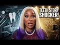 Bunz 4ever On Working w Pinky XXX Losing Her Front Teeth Right Before Filming W Rico Strong