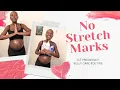How I Prevent Stretch Marks on my Pregnant Belly