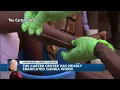 From 3 million to 13 Jimmy Carter s goal to eradicate Guinea worm disease nearly finished