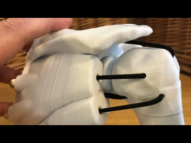 Dynamic Shoulder Rotator Cuff Education Model video thumbnail