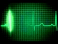 Lagu Heart Rate Monitor.mov