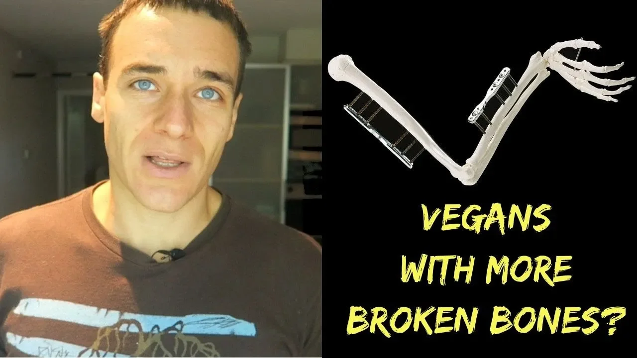 What Happens To The Bones Of Vegans Vs Omnivores