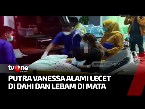 Kondisi Gala Sky, Putra Vanessa Angel Mulai Membaik