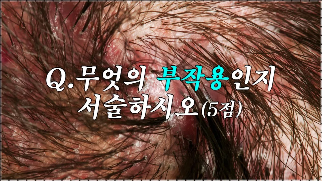 OOOO에 생길 수 있는 대표적인 부작용 2편! (지금까지 이런 디테일은 없었다!)