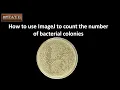 How to use ImageJ software to count the number of bacterial colonies