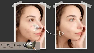 [Youtube thumbnail] removing blemishes from skin