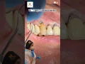 Download Lagu 🦷 From cavities to cracks, gum disease to tooth loss ⚒️🥴