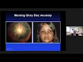 Diagnosing and Treating the Optic Disc Dr Michael C Brodsky