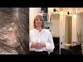 Download Lagu 2   Analyse en pathologie van het haar (Engels)