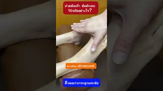  อาการปวดข้อทั้งสองข้างและข้อมือเกิดจากสาเหตุอะไรได้บ้าง 