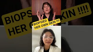 Spicule Expert Takes Her Own Biopsy to Prove it Works !!