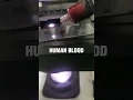 Download Lagu human blood under the microscope #laboratory #medtechstudent #mls #cls #bloodcells #microscope #bld