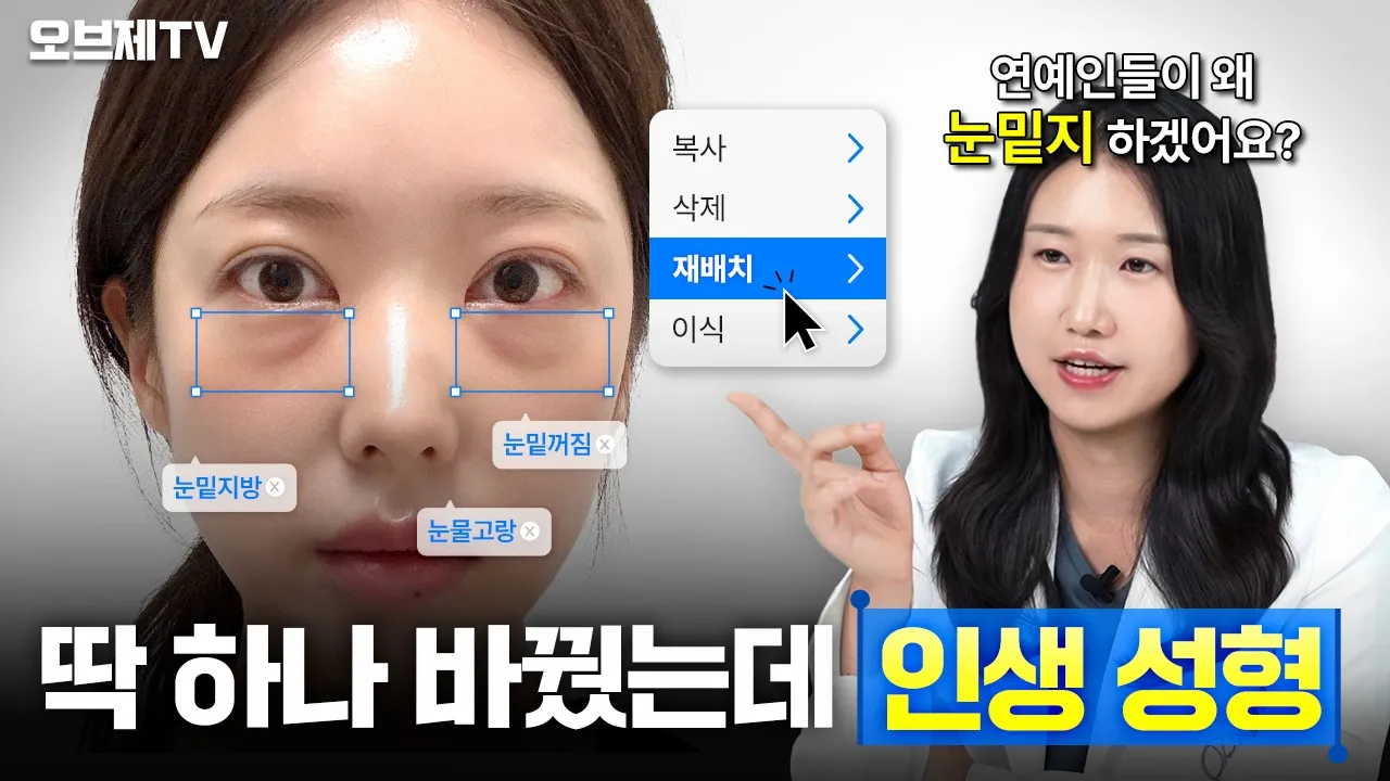 눈밑지방재배치가 '인생 성형'으로 떠오른 이유 | 성형 티 없이 눈밑지로 예뻐진다?!✨ | 오브제성형외과 윤유경 원장