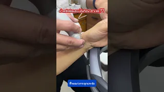  ทำไมถึงมีก้อนนูนขึ้นที่ข้อมือ และเกิดจากอะไร 