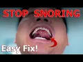 Download Lagu Stop Snoring IMMEDIATELY With This Body Hack | Physical Therapist