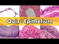 Review and Quiz Epithelium