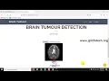 Brain Tumour Detection Using Deep Learning Python IEEE Final Year Project
