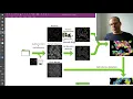 Lecture 8 1 Watershed Algorithm Clinical Application CVF20