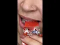 So What CAN You Eat With Braces