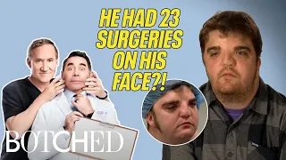 Nate Had 2 MILLION Worth of Surgery for His Facial Difference Before After Botched E