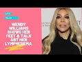 WENDY WILLIAMS SHOWS HER FEET TALKS ABT HER LYMPHEDEMA