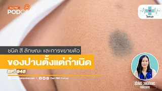 ปานแต่กำเนิดมีกี่ชนิดหลัก ๆ