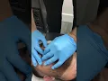 DEVIATED SEPTUM adjustment IMPROVES Breathing by Gonstead Chiropractor