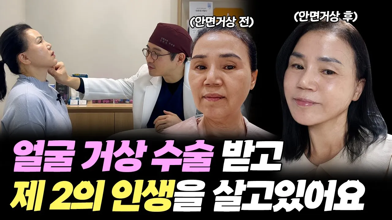 50대 안면거상 수술 후기│얼굴주름 리프팅│수술 당일부터 6개월차까지의 기록