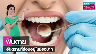 การนอนกัดฟันทำให้เกิดฟันตายได้อย่างไร