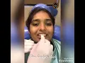 Technique of recording centric relation bite record with leaf gauge