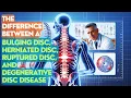 The Difference Between A Bulging Disc Herniated Disc Ruptured Disc And Degenerative Disc Disease
