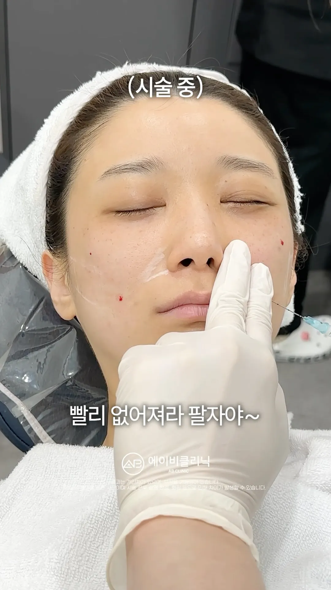 팔자주름 없애고 5년 더 어려지기 😖