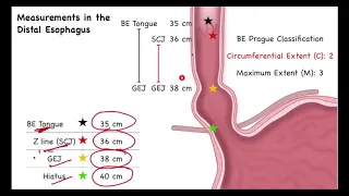 Zoom Class 3 Esophageal Anatomy for Endoscopy Trainees Nurses and Techs