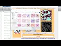 Leukemia Blood Cancer Detection Using CNN Convolutional Neural Network Leukemia Detection