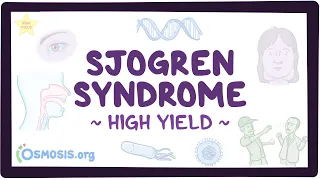 Sjogren syndrome: Pathology review