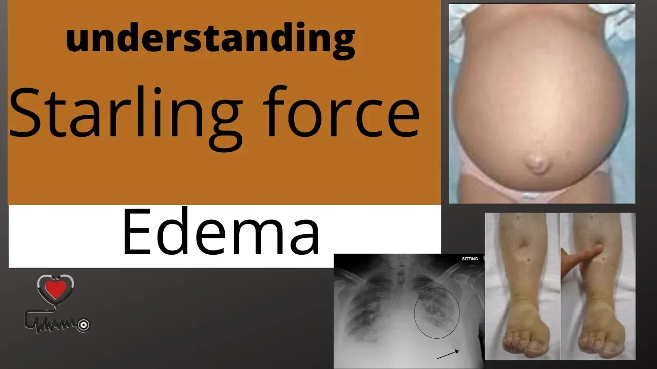 Starling force | basics of edema | physiology basics | Med Madness