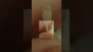 رفضت الام عملية الاجهاض و جت رسالة أن الجنين يكون مكتملا رغم صغر حجمه ووزنه 