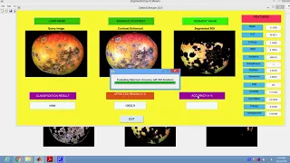 Detection and Classification of Apple Fruit Diseases using Complete Local Binary Patterns in Matlab