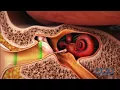 How the Ear Works - 3D Medical Animation ABP