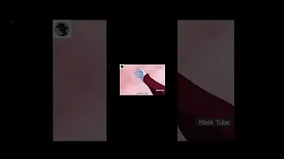 أنمي دراغون بول سوبر هيروز أارك كوكب السجن 