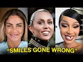 15 Celebrity Veneers Gone Wrong Before After 2026
